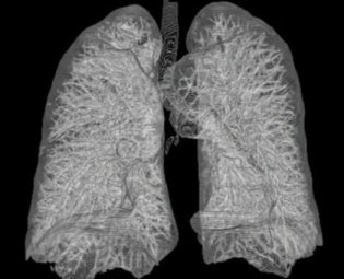 lungs_1